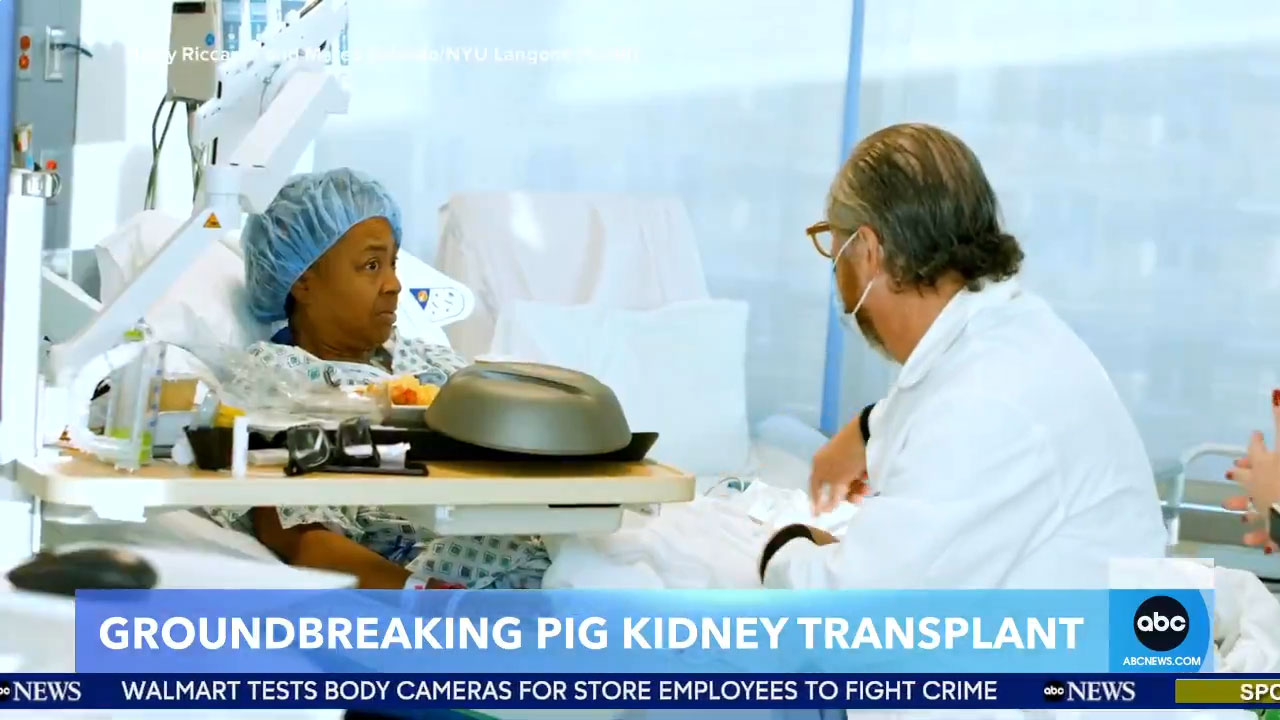 An Alabama woman has become only the fifth person in the world to receive a genetically-modified organ from a pig after undergoing a kidney transplant